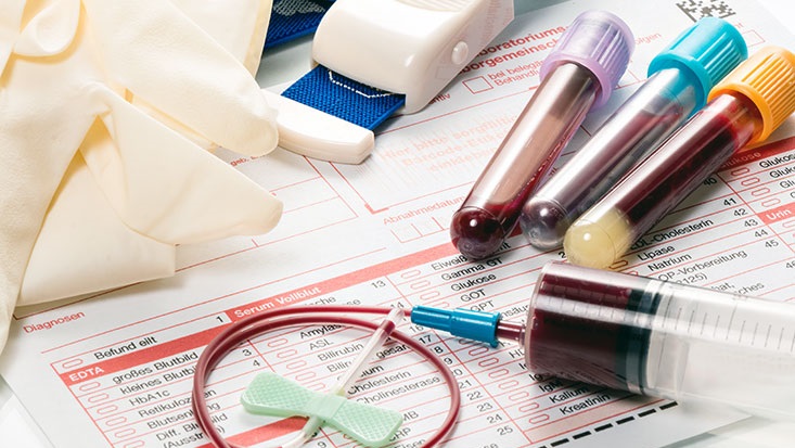 blood-draw-733-450 (1)